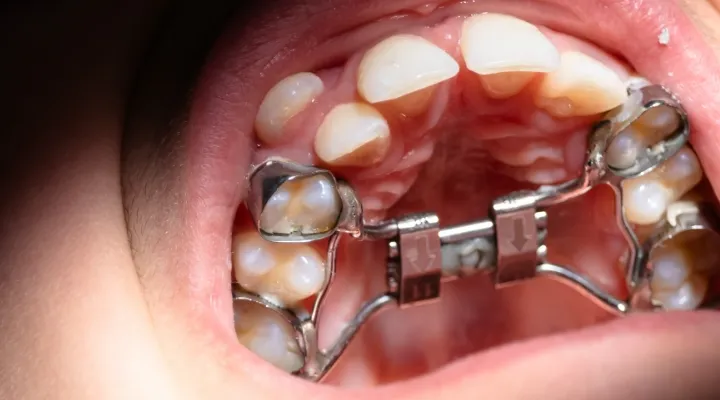 hp medicina dentaria ortodontia